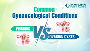 Fibroids Cysts